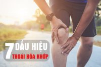 7-dau-hieu-thoai-hoa-khop
