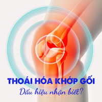 GOI