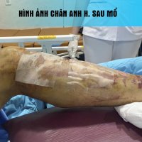 NGUYEN_ANH_HUNG_01