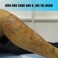 NGUYEN_ANH_HUNG_02