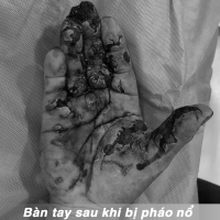 PHAO_NO