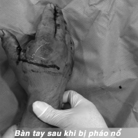 PHAO_NO_01