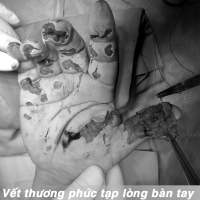 PHAO_NO_02