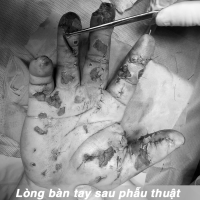 PHAO_NO_03