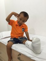 be_4_tuoi_bong