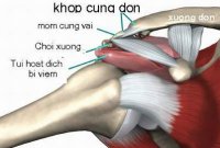 bi_dau_quanh_vai_chua_the_nao