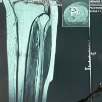 mri-01