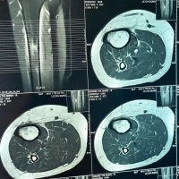 mri