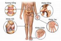 thoai-hoa-khop-01