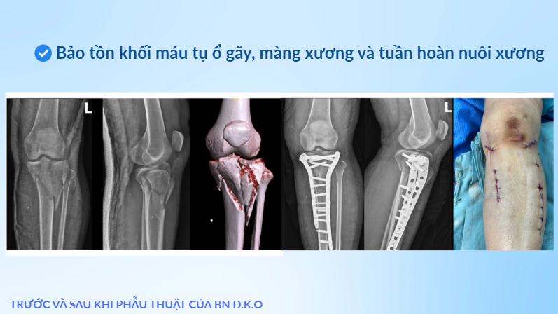 saigonito mipo uudiem
